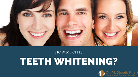 teeth whitening cost