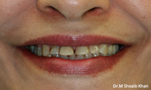 before and after dental arlington heights