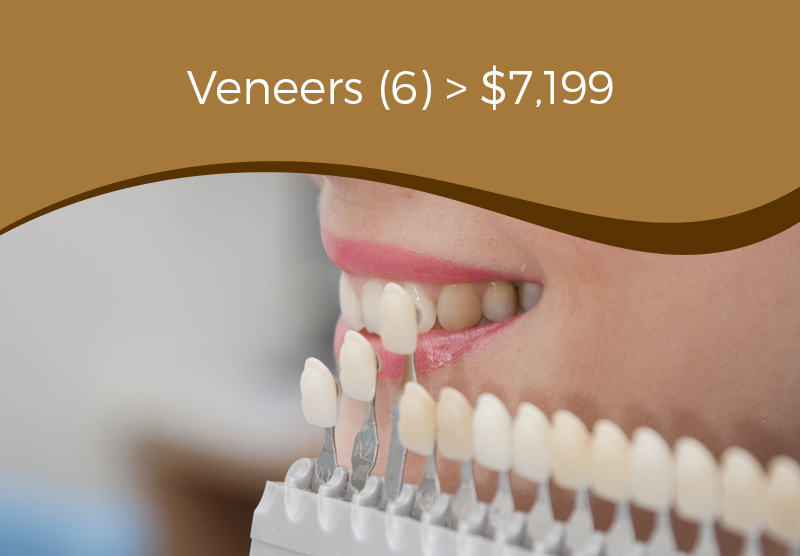 dental veneers arlington heights
