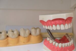 Dental-Bridges-Dr M S Khan