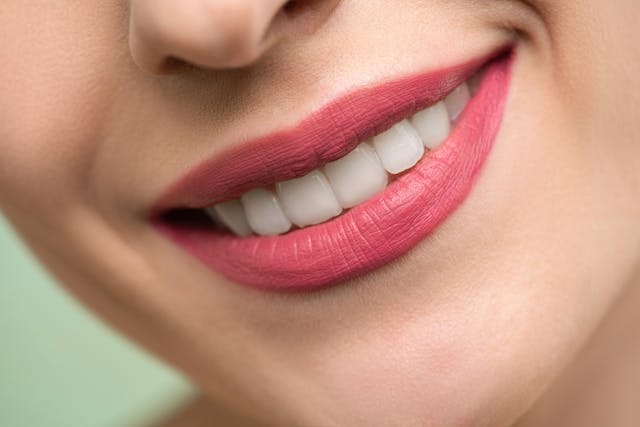 Smile After Teeth Whitening - Dr.Khan