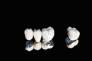 arlington heights dental crowns
